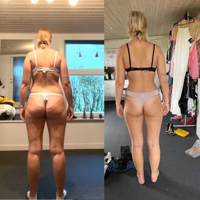 Sofia ryg